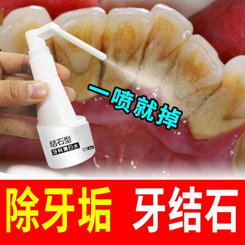 蓝尼芳可 Lnfk 眼部走珠 牙结石3天脱落 牙结石溶解牙洁石牙垢溶解牙菌斑牙垢牙科清扫水 单盒体验装 价格图片品牌报价 苏宁易购大白熊彩妆专营店
