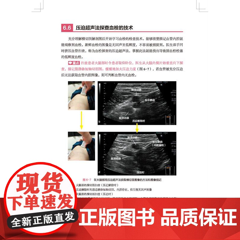 床旁即时超声 全书共10章 介绍了床旁超声在气道管理 呼吸系统 循环系统 中枢神经系统 下肢静脉血栓 腹部 运动系统 血高清大图