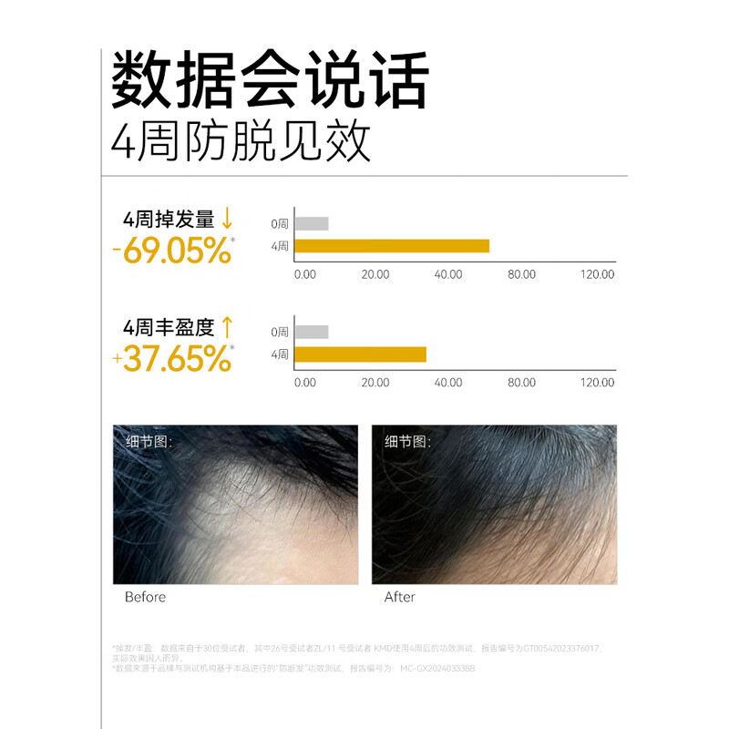 长发小寨固发防脱强韧洗发露A170高清大图