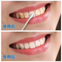 [买二发三瓶]樱瑞洗牙粉牙齿亮洁牙粉牙黄成人[1瓶装] 50克