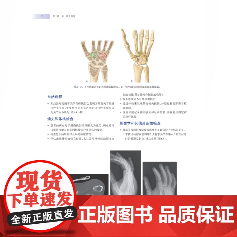 WIESEL骨科手术学·创伤外科 骨科手术技术精髓佳作手把手教学上海科学技术出版社高清大图