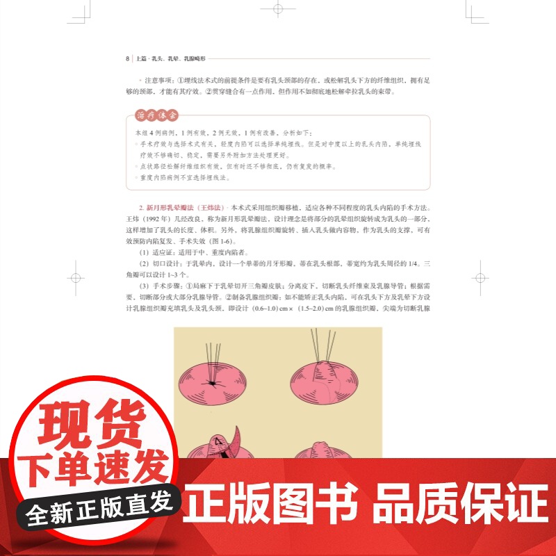 私密整形外科手术图解 外生殖器畸形美容外科乳腺外科上海科学技术出版社临床医学外科学高清大图