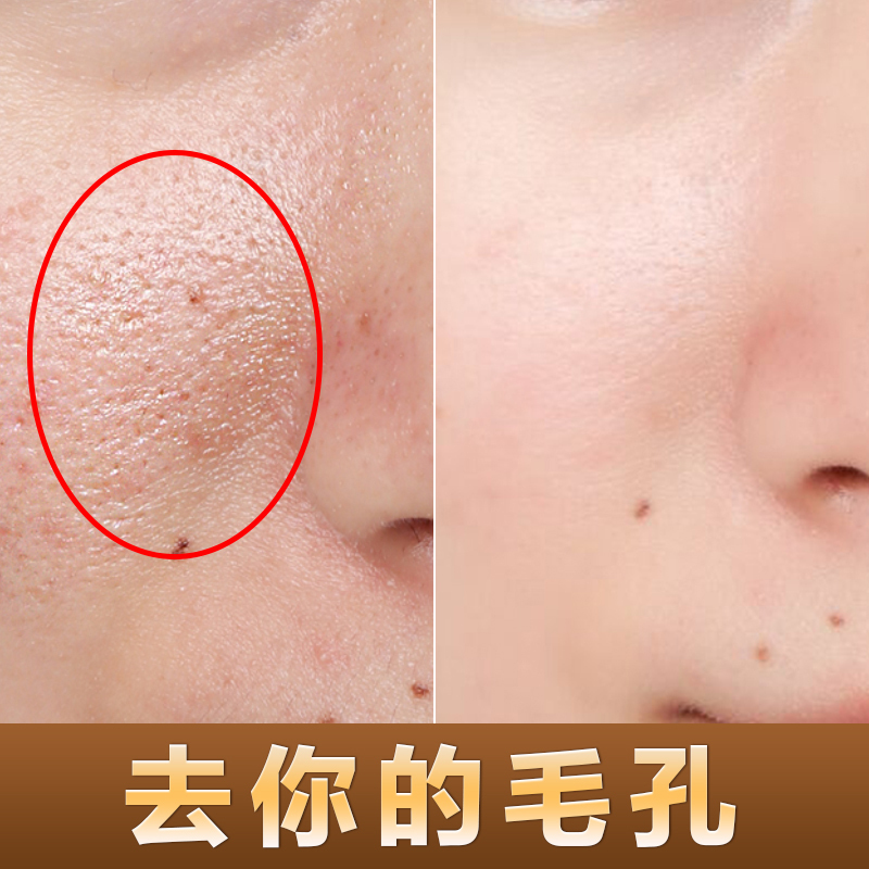 梵西毛孔收缩精华液面部紧致毛孔粗大修复痘黑头闭合性粉刺