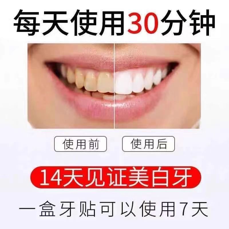 南京同仁堂美白牙贴去黄速效亮白牙齿变白烟渍茶渍洗黄牙贴片牙膏 [一盒]7对14贴(基础净白)