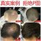 九叶洗发 [优先发货]老姜王生姜洗发水防脱生发增发密发快速变长控油去屑洗发露350ml
