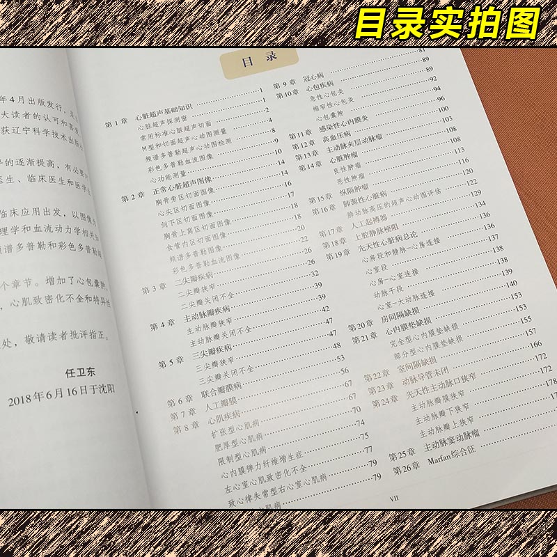 [醉染正版]正版 心脏超声诊断图谱 第二版 主编任卫东 张立敏 辽宁科学技术出版社9787559109224高清大图