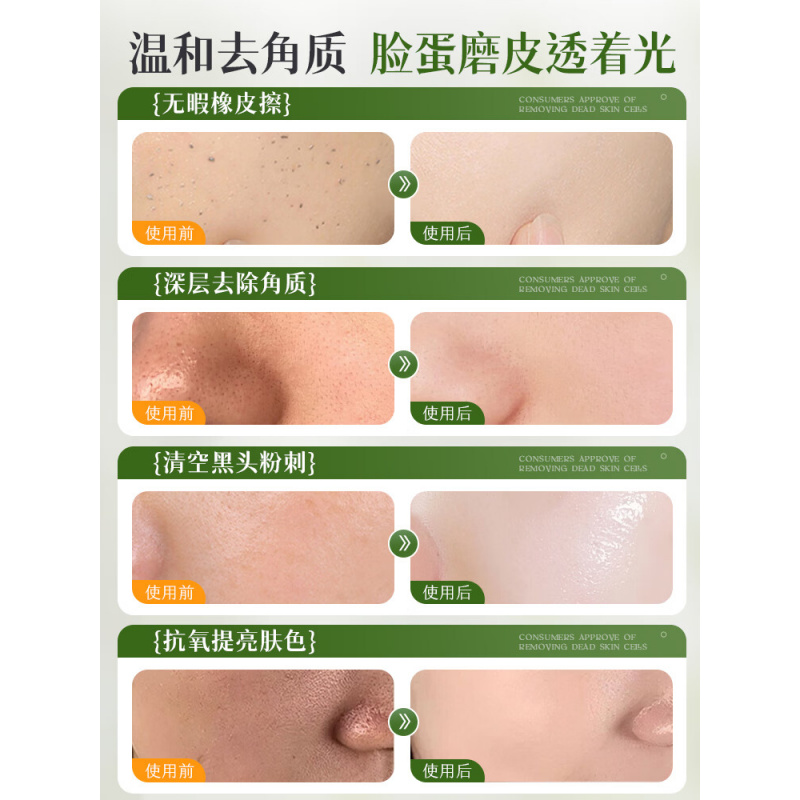 RUYI儒意芦荟果酸滋润去角质啫喱300g高清大图