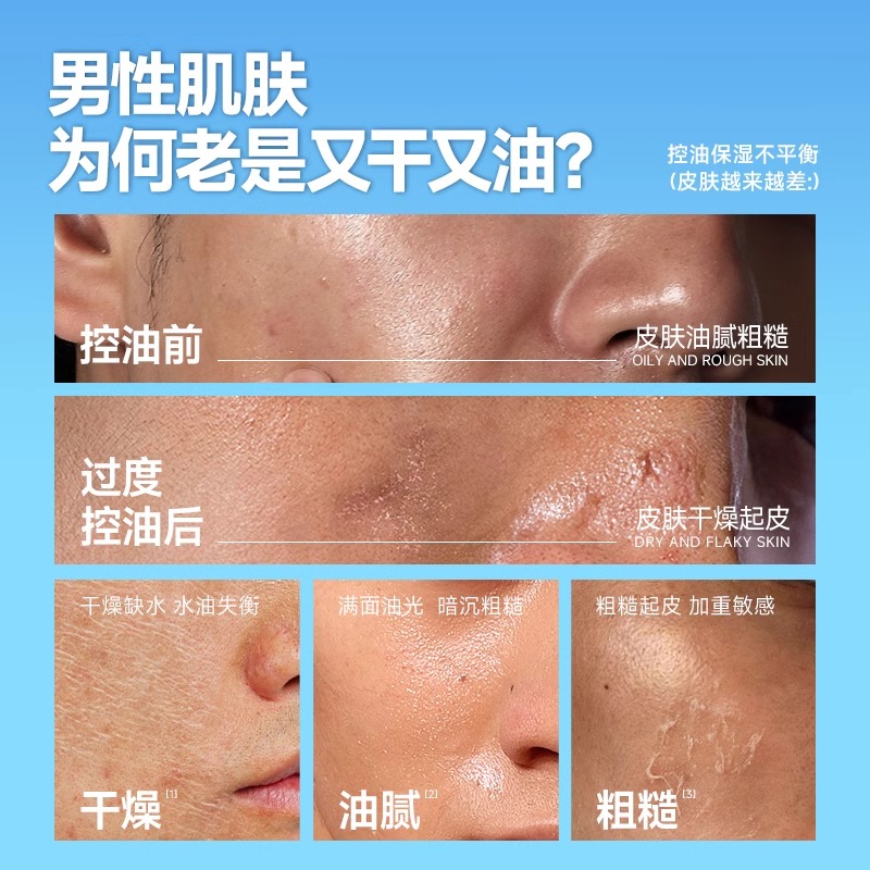 左颜右色 微酸 净肤套装(3件套)高清大图