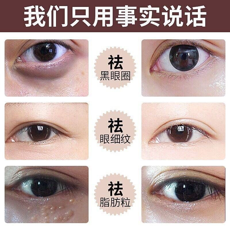 鲟鱼子酱眼霜 去鱼尾纹黑眼圈眼袋细纹柔润肌肤眼部紧致眼霜