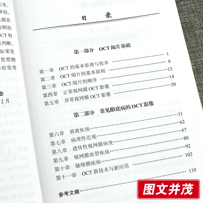 [正版] 简明OCT阅片手册 眼底病眼科OCT影像分析与解读 俞素勤编著 基础阅片影像眼科学视光技术应用 人民卫生出版高清大图