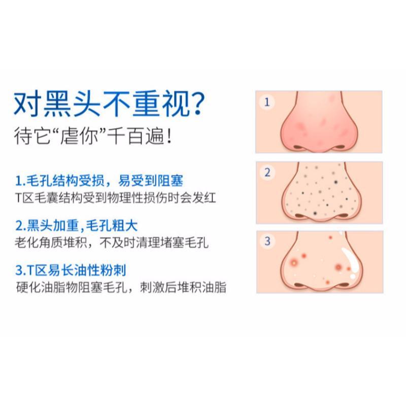 韩国小气泡黑头导出液美容院专用去粉刺精华毛孔收缩深层清洁男女