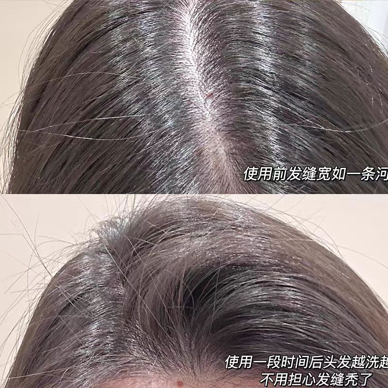 滋源(SEEYOUNG)强根健发防脱洗头水(油性)535ml高清大图