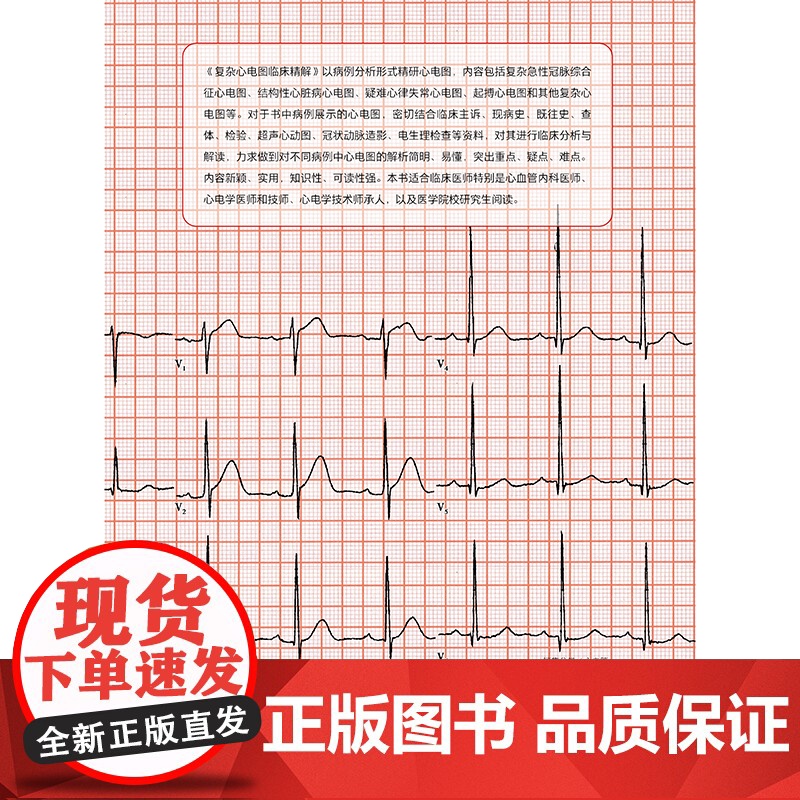 复杂心电图临床精解 卢喜烈 孙志军 人民卫生出版社9787117365611心电图临床解读高清大图