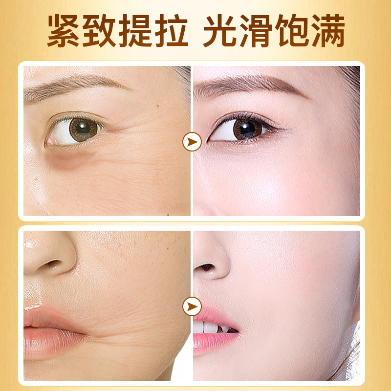 欧佩(OU PEI)黄金蛋白精华套装 黄金线雕提拉紧致淡化细纹面部精华液套盒