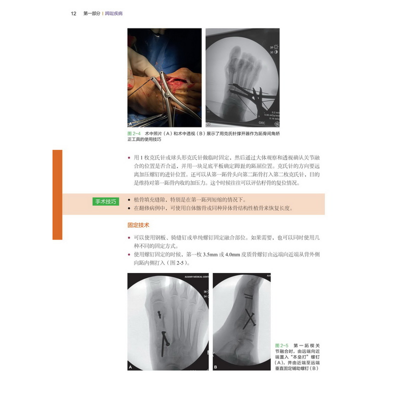 醉染图书Hospital for Special Surgery’s Illustrated Tips a高清大图
