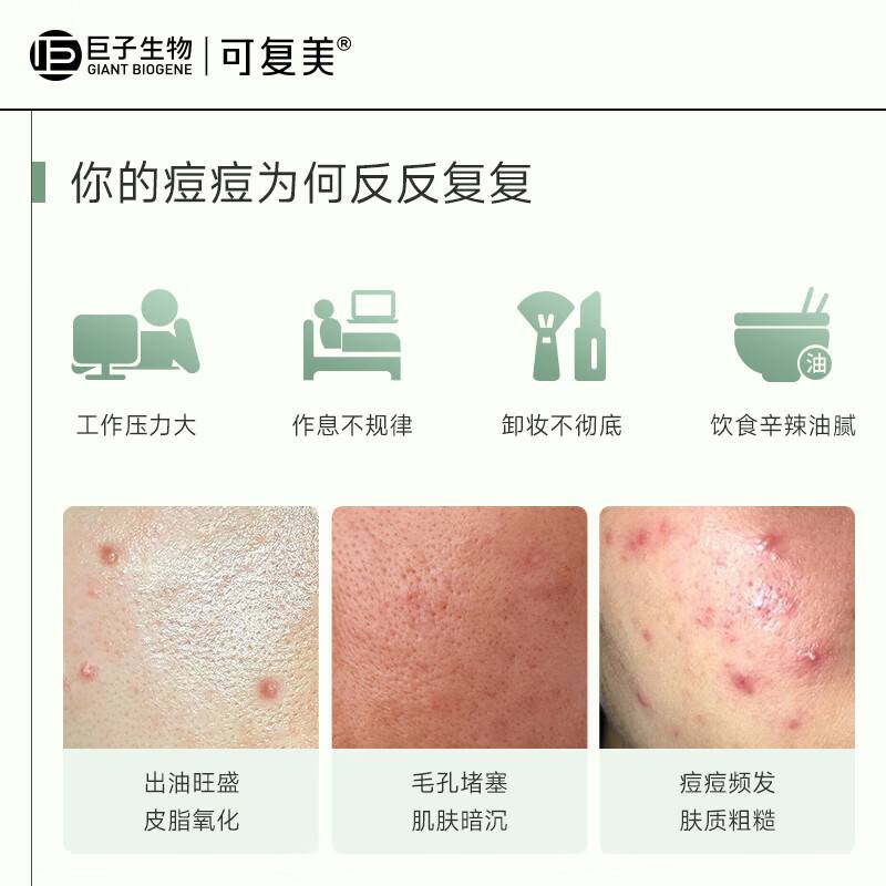(可复美)净痘修护面膜(5片/盒)(jz-6516)严选高清大图