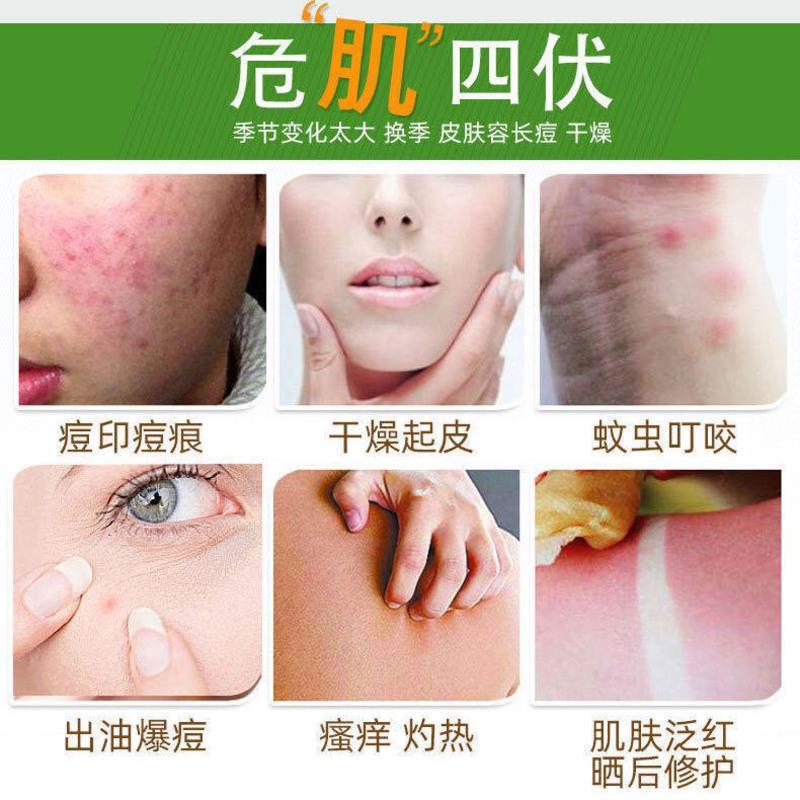 真99%芦荟胶补水保湿美白祛痘淡印学生植物啫喱面霜晒后修复 1瓶300g[99%芦荟胶]
