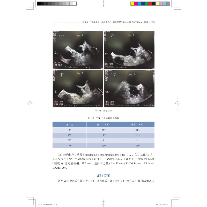 醉染图书左心耳封堵术病例集9787547858998高清大图