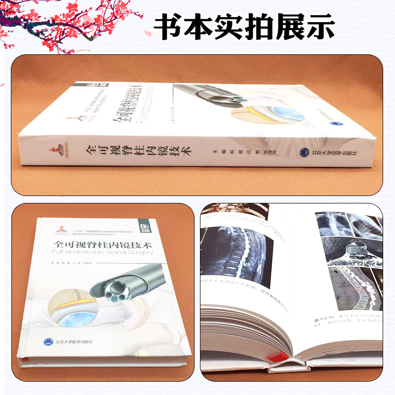 [正版]全可视脊柱内镜技术 北京大学医学出版社 9787565930157