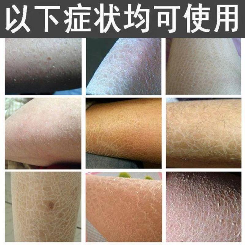 [一抹掉光鸡皮]鱼鳞皮肤霜草本润肤保湿皮肤干燥身体乳皮肤修复 一瓶[开始体验装]