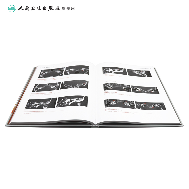 [正版]耳疾病与CT(第2版)2022年8月参考书 9787117331869高清大图