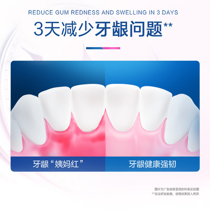欧乐B牙龈专护牙膏90g oralb牙膏劲爽薄荷红肿早晚白含氟舒缓