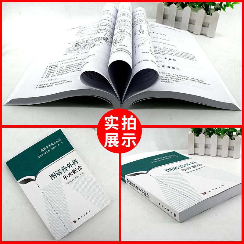[正版]图解普外科手术配合 图解手术配合丛书 谭永琼 科学出版社 适合于初入手术室工作 手术室护士的三基三严培训书籍高清大图