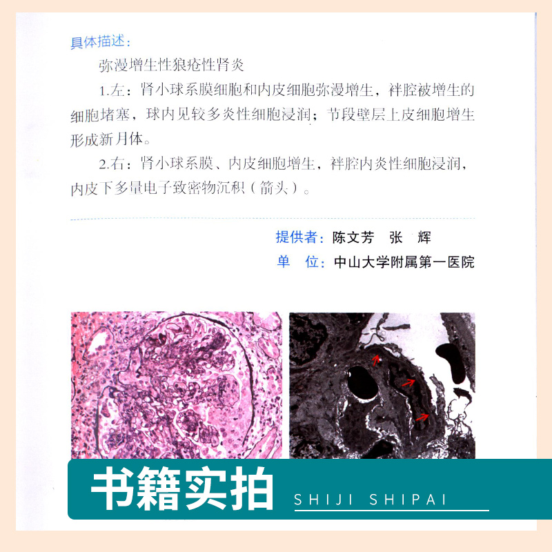 [醉染正版]风湿图鉴 赵久良 吴歆 朱小霞 耿研 风湿免疫病学临床图鉴图谱图谱病理学影像学检查诊断书籍风湿免疫科风湿病书高清大图