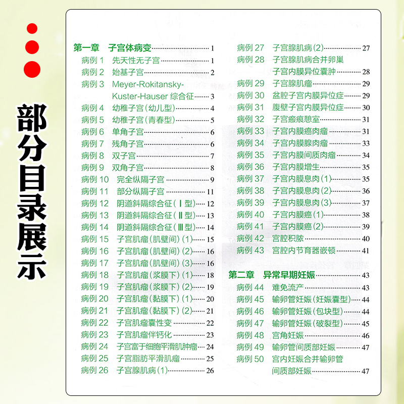 [正版]妇科疾病超声图解100例 人民卫生出版社 9787117346191高清大图