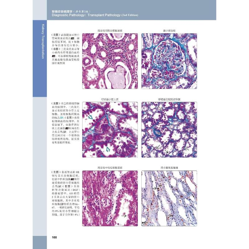 醉染图书移植诊断病理学 原书第2版9787504690555高清大图