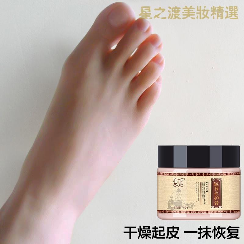 [优选好货]脚裂一抹恢复脚后跟干裂滋润保湿防裂润足修护霜脚膜护足霜护脚霜