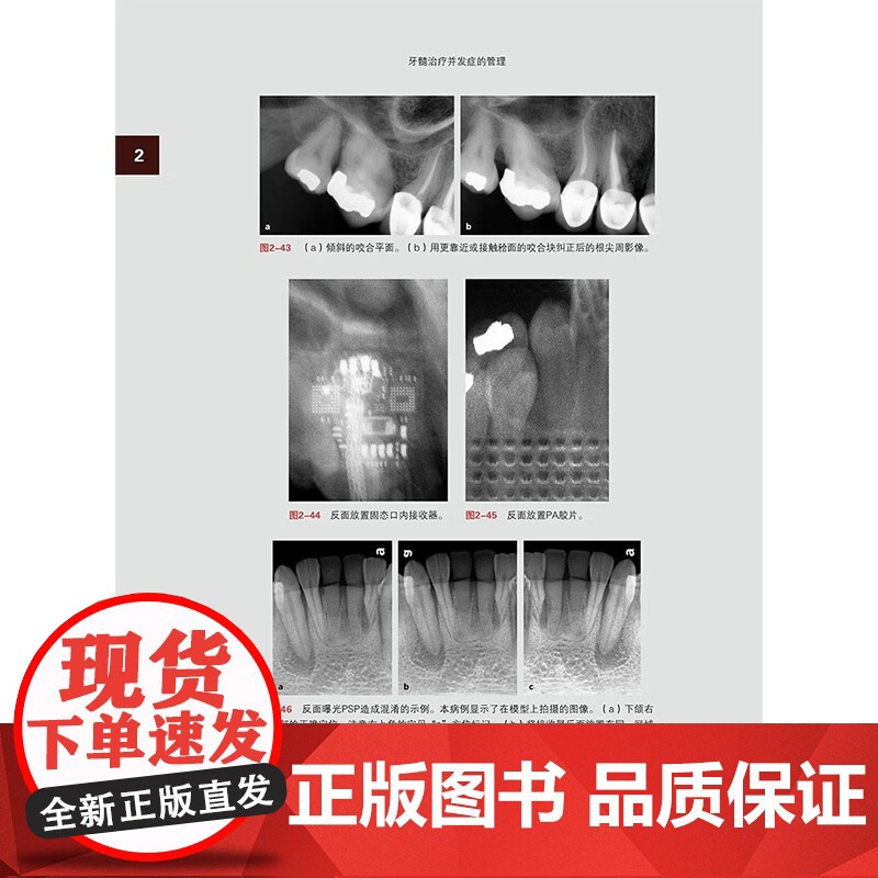 [出版社]牙髓治疗并发症的管理 赵今 连冰洁 诊断和治疗过程中并发症 影像学检查过程中失误清理和成形 辽宁科学技术出版社高清大图