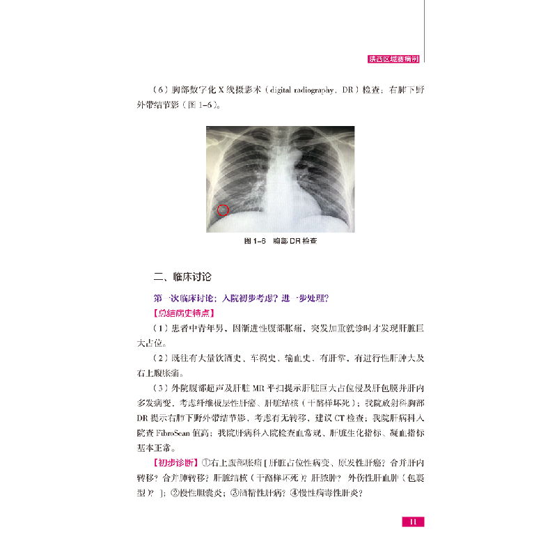 醉染图书2018肝病临床思维训练营病例合集9787518959051高清大图