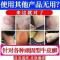 1[一抹就消]全身手脚大腿内侧百肤膏抑菌乳膏皮肤外用乳膏 一盒装