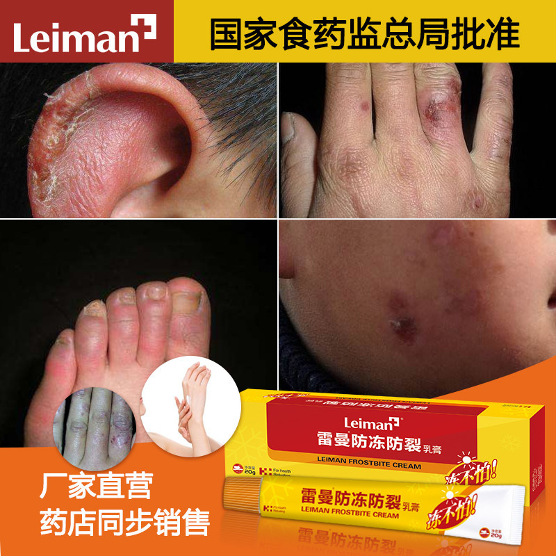 雷曼防冻防裂膏20g 冻疮膏防冻疮护手霜手脚耳朵止痒消肿滋润修复