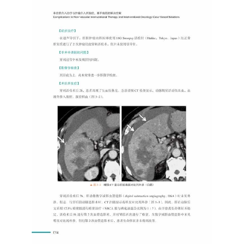 正版新书]非血管介入治疗与肿瘤介入并发症:基于病例的解决方案高清大图
