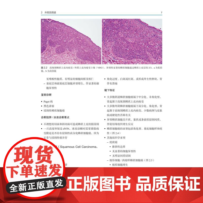 妇科病理术中冰冻诊断图谱 妇科医学 妇科肿瘤治疗 病理 临床特征 北京科学技术高清大图