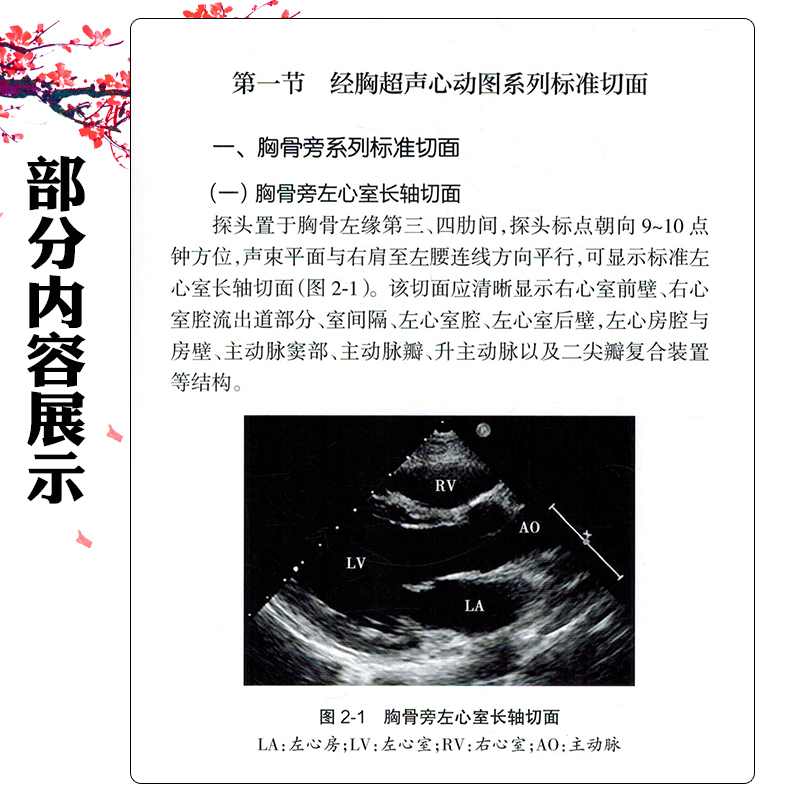 中国心脏超声检查指南 中国医师协会超声医师分会 人民卫生出版社 中国医师协会超声医师分会指南丛书 适合各 [正版]中国心高清大图