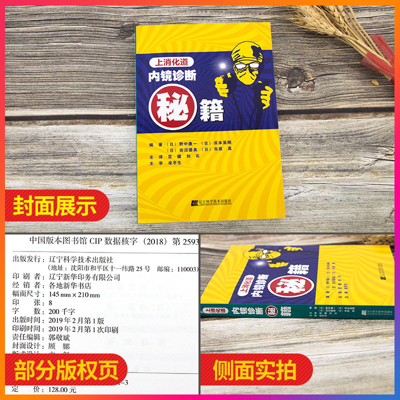 [醉染正版]上消化道内镜诊断秘籍 日 野中康一 食管表浅癌Barrett食管腺癌胃溃疡早期胃癌鉴别诊断书籍 内镜诊断与鉴高清大图
