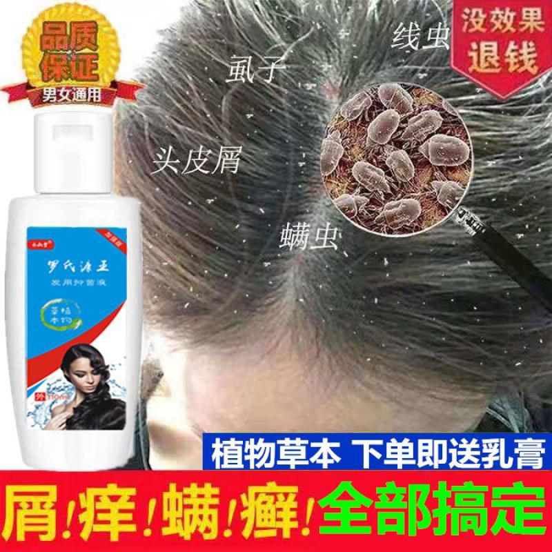 [优先发货]康王去屑止痒洗发水医药正品虱子控油虫头皮防脱生霜男女神器 550mL