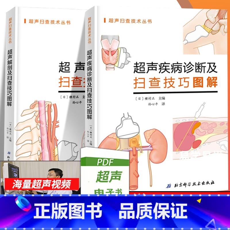 【正版】超声疾病诊断及扫查技巧图解+超声解剖及扫查技巧图解书籍正常值测量备忘录技术入门b超血管肌骨心超笔记腹部精细讲解心