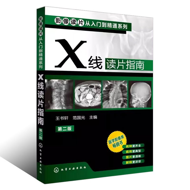 [正版]X线读片指南 第二版 王书轩 化学工业出版社 全面覆盖基层常见病及多发病中枢神经系统与头颈部读片基础书籍