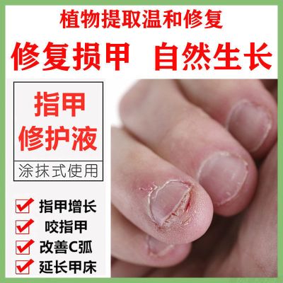 1瓶[体验装]建议购买3瓶 [官方正品]指甲快速修复液 指甲生长液护甲营养油咬指甲水修复液防断养甲改善甲床甲面快速