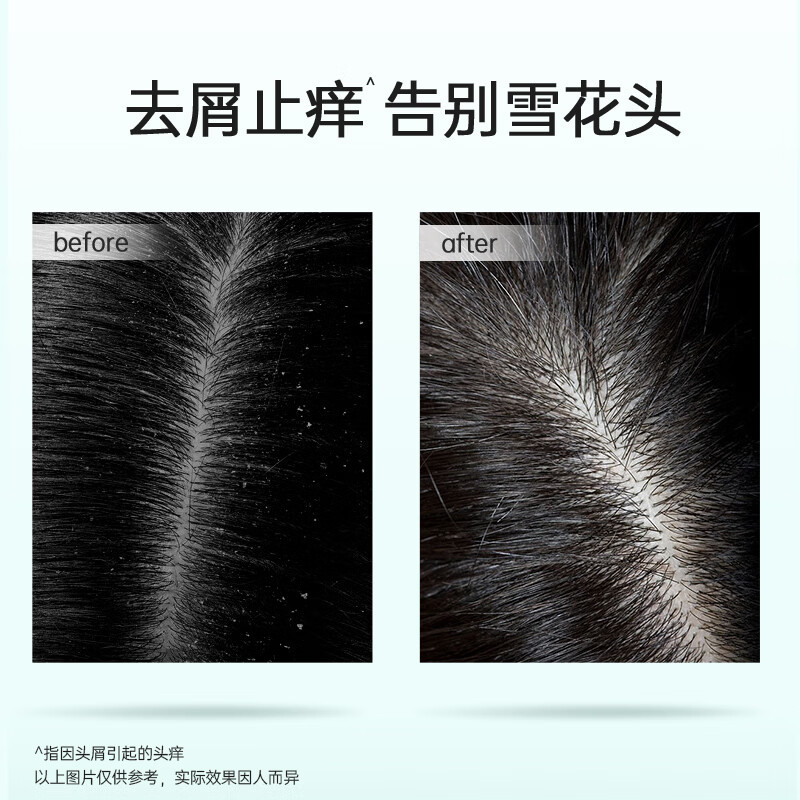 滋源 茶籽控油去屑洗头水400ml(单位:件)