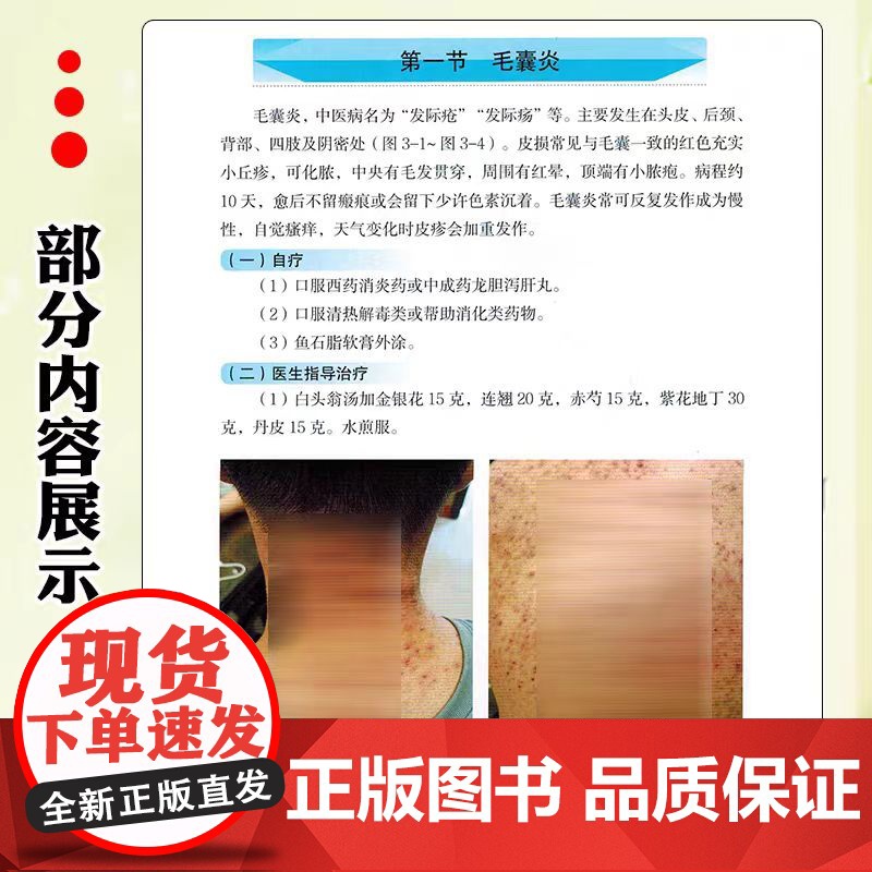正版 常见皮肤病诊疗图谱 辽宁科学技术出版社 9787559131935高清大图