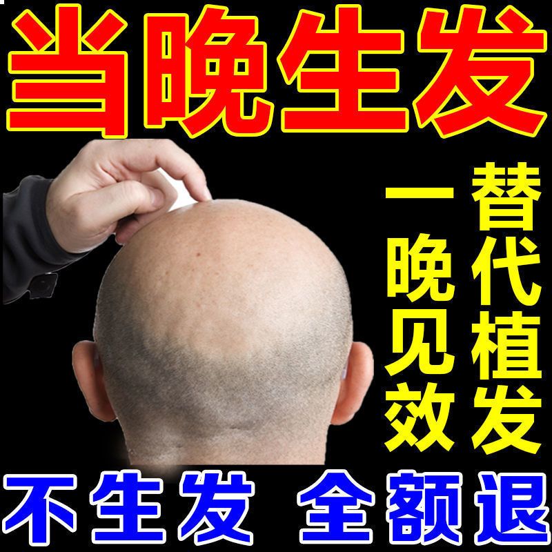 [生新发]育发生发剂增发密发育发液秃顶增长液快速变长头发 单瓶体验装[防脱加生发2000根] 当天生新发 不生发