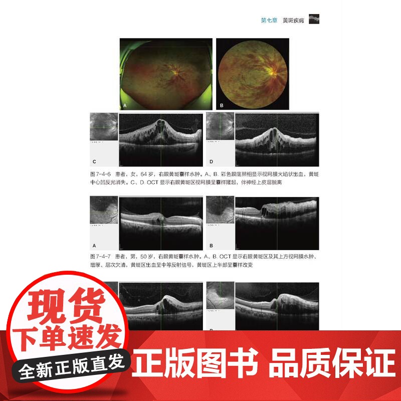 简明眼科相干光断层扫描操作阅片手册 图文并茂 病例分析 北京科学技术高清大图