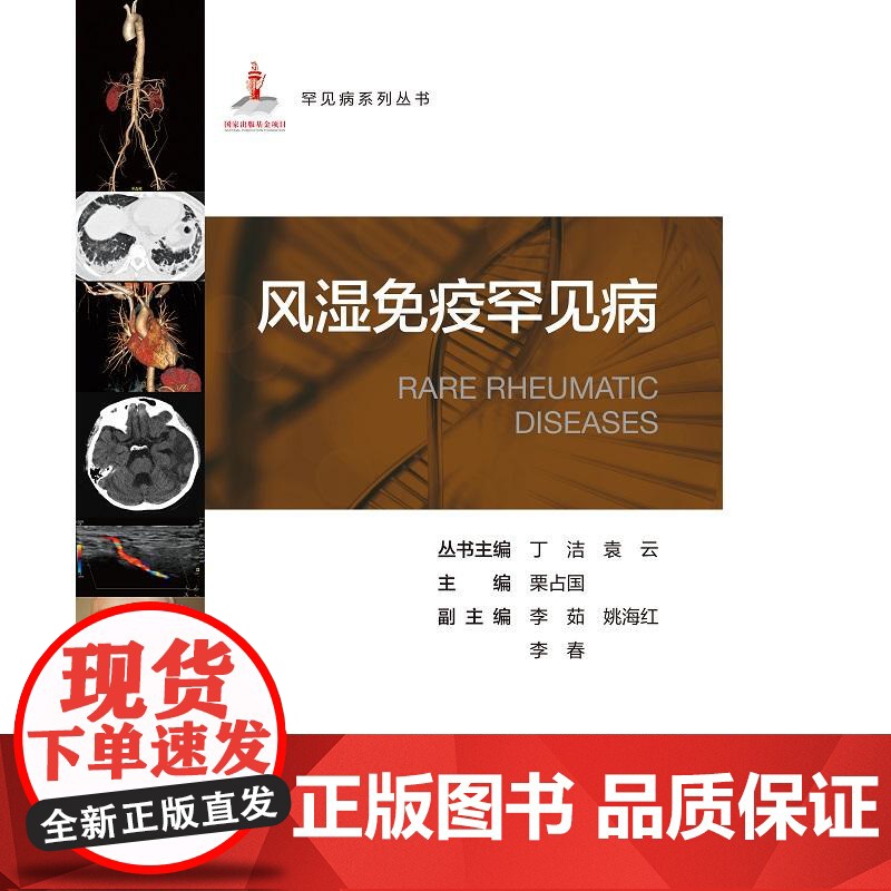 风湿免疫罕见病 罕见病系列丛书 栗占国主编 系统性自身免疫病 自身炎症性疾病 纤维炎性及淋巴增生性疾病 北京大学医学出版高清大图