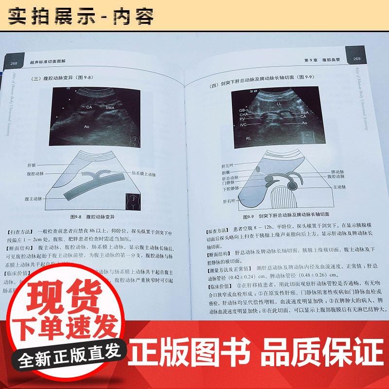 超声标准切面图解(修订版) 科学出版社 9787030590220高清大图