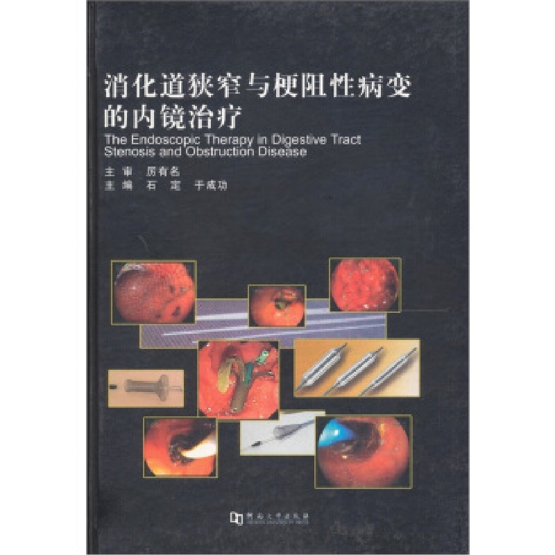 正版新书】消化道狭窄与梗阻性病变的内镜治疗石定、于成功978781